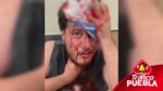 Integrante de la comunidad fue agredido en Puebla